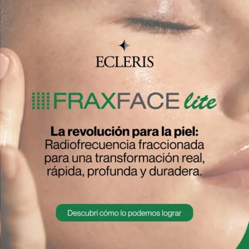 FRAX FACE Radiofrecuencia Fraccionada.