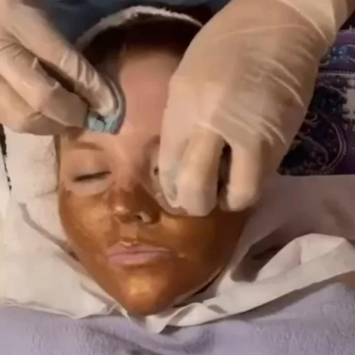 Limpieza facial con Hidratacion y Alta frecuencia