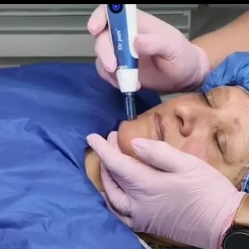 Microneeding