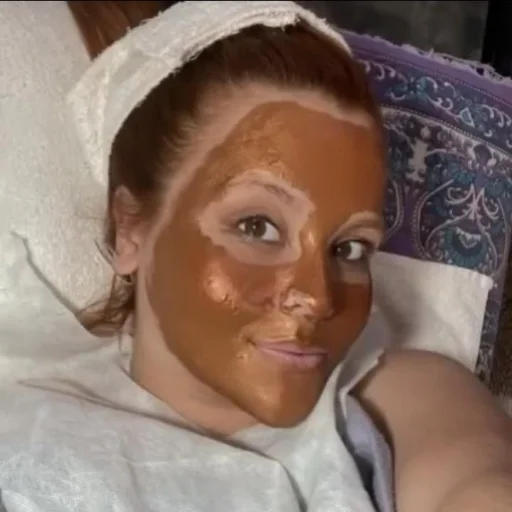 Limpieza facial con Hidratacion y Alta frecuencia