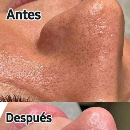 Limpieza facial